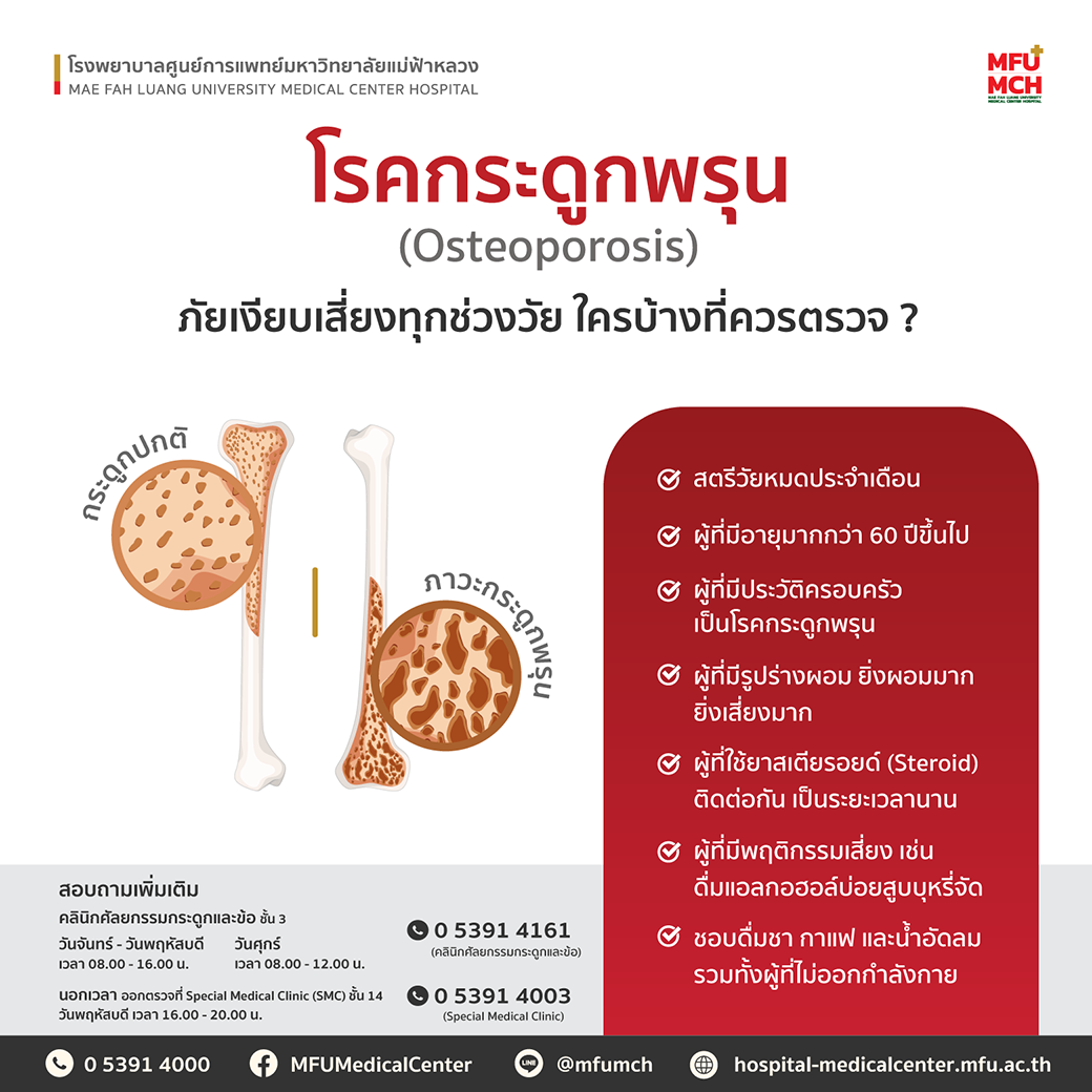 ป้องกันโรคกระดูกพรุนด้วยการตรวจวัดมวลกระดูก ที่ศูนย์รังสีวิทยา โรงพยาบาลศูนย์การแพทย์ฯ
